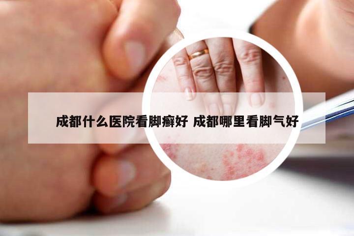 成都看皮肤病